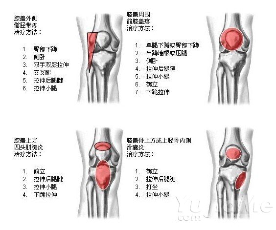 膝關(guān)節(jié)不同部位的疼痛